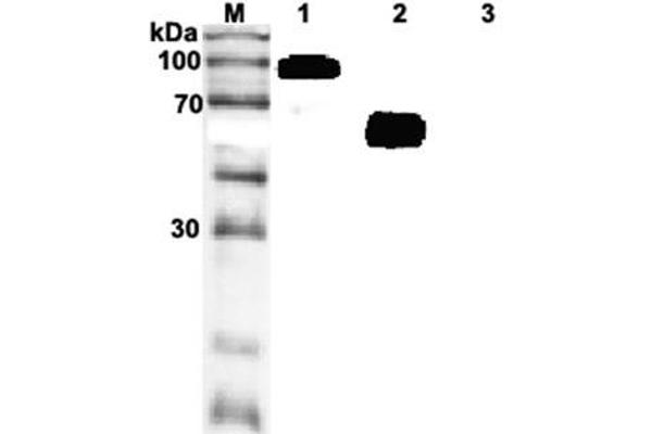 IL1RL1 anticorps