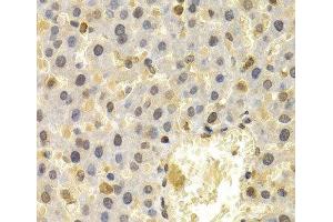 Immunohistochemistry of paraffin-embedded Rat liver using UBD Polyclonal Antibody at dilution of 1:200 (40x lens).