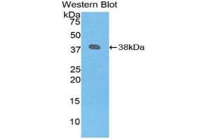 PLG Antikörper  (AA 274-560)