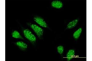 Immunofluorescence of purified MaxPab antibody to PDE4DIP on HeLa cell.