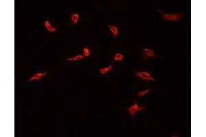 Image no. 1 for anti-COP9 Signalosome Complex Subunit 3 (COPS3) (C-Term) antibody (ABIN6260969)