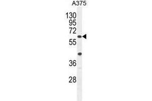 Image no. 3 for anti-APOBEC1 Complementation Factor (A1CF) (AA 397-427), (C-Term) antibody (ABIN950458)