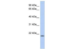 CHAC2 anticorps  (N-Term)