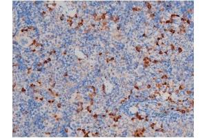Image no. 3 for anti-V-Akt Murine Thymoma Viral Oncogene Homolog 1 (AKT1) (pSer124) antibody (ABIN6256119)