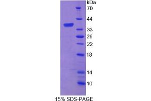 Image no. 1 for Protein tyrosine Phosphatase, Receptor Type, G (PTPRG) (AA 848-1119) protein (His tag) (ABIN6236999)