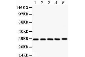 Image no. 2 for anti-serine/arginine-Rich Splicing Factor 1 (SRSF1) (AA 6-33), (N-Term) antibody (ABIN3043296)