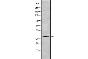 Image no. 1 for anti-Major Histocompatibility Complex, Class II, DR beta 1 (HLA-DRB1) antibody (ABIN6262291)