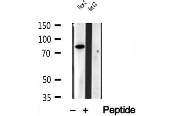 PLOD3 anticorps  (C-Term)