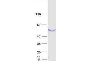 Image no. 1 for BPI Fold Containing Family B, Member 1 (BPIFB1) protein (Myc-DYKDDDDK Tag) (ABIN2724881)
