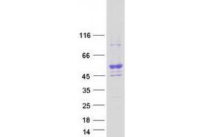 Image no. 1 for Smith-Magenis Syndrome Chromosome Region, Candidate 7 (SMCR7) (Transcript Variant 1) protein (Myc-DYKDDDDK Tag) (ABIN2732246)