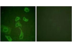 Image no. 2 for anti-Interleukin 2 Receptor, beta (IL2RB) (AA 331-380) antibody (ABIN1532688)