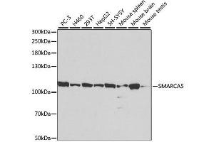 Image no. 3 for anti-SWI/SNF Related, Matrix Associated, Actin Dependent Regulator of Chromatin, Subfamily A, Member 5 (SMARCA5) antibody (ABIN3022717)