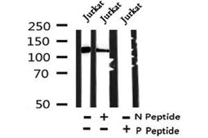 Image no. 1 for anti-Tumor Protein P53 Binding Protein 2 (TP53BP2) (pSer698) antibody (ABIN6267846)