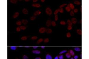 Immunofluorescence analysis of HeLa cells using JNK1 Polyclonal Antibody at dilution of 1:100 (40x lens).
