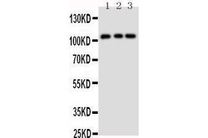 Image no. 3 for anti-Transient Receptor Potential Cation Channel, Subfamily C, Member 6 (TRPC6) (AA 249-265), (Middle Region) antibody (ABIN3044146)