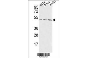 Image no. 1 for anti-Hyaluronan and Proteoglycan Link Protein 1 (HAPLN1) (AA 10-38), (N-Term) antibody (ABIN653748)