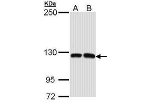 Image no. 1 for anti-MCF.2 Cell Line Derived Transforming Sequence-Like (MCF2L) (N-Term) antibody (ABIN2856858)