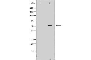 Image no. 1 for anti-Solute Carrier Family 1 (Glutamate/Neutral Amino Acid Transporter), Member 4 (SLC1A4) (C-Term) antibody (ABIN6266271)