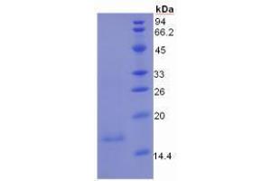 Image no. 1 for Mucin 5 Subtype B (MUC5B) protein (ABIN3010769)
