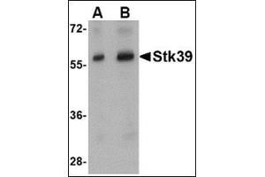 Image no. 2 for anti-serine threonine Kinase 39 (STK39) (Center) antibody (ABIN500835)