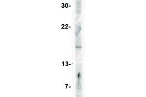 Image no. 3 for anti-Interferon, beta 1, Fibroblast (IFNB1) (Internal Region) antibody (ABIN6655800)