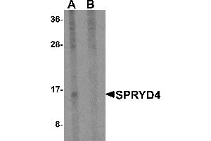 Western blot analysis of SPRYD4 in mouse kidney tissue lysate with SPRYD4 antibody at 1 µg/mL in (A) the absence and (B) the presence of blocking peptide