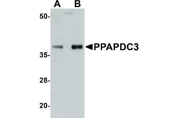 PPAPDC3 Antikörper
