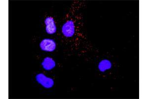 Image no. 3 for anti-V-Crk Sarcoma Virus CT10 Oncogene Homolog (Avian) (CRK) (AA 1-204) antibody (ABIN514602)