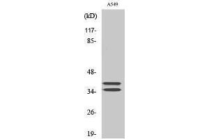 Image no. 1 for anti-Linker For Activation of T Cells (LAT) (Tyr660) antibody (ABIN3185362)