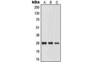 Image no. 1 for anti-Major Intrinsic Protein of Lens Fiber (MIP) (Center) antibody (ABIN2705496)
