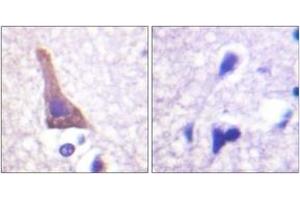 Immunohistochemistry analysis of paraffin-embedded human brain, using Adrenergic Receptor beta2 (Phospho-Ser346) Antibody.
