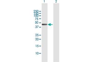 Image no. 3 for anti-Interferon Regulatory Factor 9 (IRF9) (AA 1-393) antibody (ABIN523770)