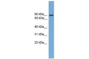 Image no. 1 for anti-DEP Domain Containing 1 (DEPDC1) (Middle Region) antibody (ABIN928841)