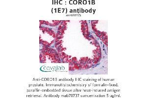 Image no. 2 for anti-Coronin, Actin Binding Protein, 1B (CORO1B) (AA 1-490), (full length) antibody (ABIN1723594)