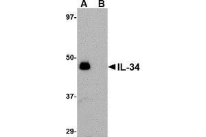 Image no. 1 for anti-Interleukin 34 (IL34) (N-Term) antibody (ABIN500016)
