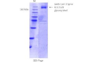 Image no. 1 for SARS-CoV-2 Spike (B.1.1.529 - Omicron) protein (rho-1D4 tag) (ABIN7041433)