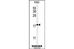 Image no. 1 for anti-Keratin Associated Protein 1-1 (KRTAP1-1) (AA 88-117) antibody (ABIN651241)