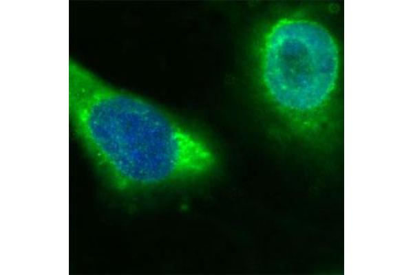 CD36 anticorps  (Extracellular Domain)