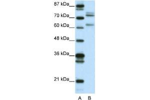 Image no. 1 for anti-GATA Zinc Finger Domain Containing 2B (GATAD2B) (N-Term) antibody (ABIN2777674)
