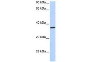 Image no. 1 for anti-Sex Comb On Midleg-Like 1 (SCML1) (AA 36-85) antibody (ABIN6740440)