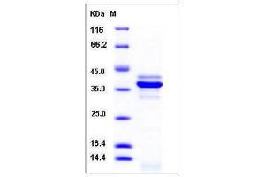 Image no. 1 for Cathepsin L1 (CTSL1) (AA 1-334) protein (His tag) (ABIN2007149)