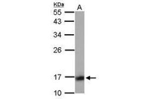 Image no. 1 for anti-Protein Phosphatase 3, Regulatory Subunit B, alpha (PPP3R1) (AA 1-154) antibody (ABIN1500385)