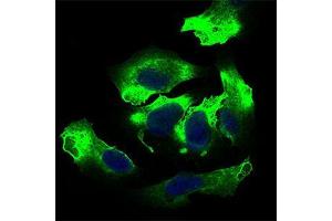 Image no. 3 for anti-Activated Leukocyte Cell Adhesion Molecule (ALCAM) (AA 48-216) antibody (ABIN1724851)
