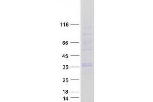 Image no. 1 for Gap Junction Protein, beta 4, 30.3kDa (GJB4) protein (Myc-DYKDDDDK Tag) (ABIN2721892)