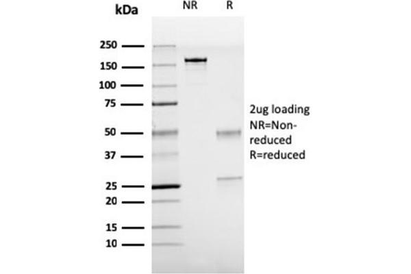 NKX2-1 antibody
