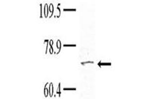 Image no. 1 for anti-Tyrosine Kinase, Non-Receptor, 1 (TNK1) (Center) antibody (ABIN2497280)
