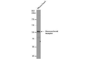 WB Image Glucocorticoid receptor antibody detects Glucocorticoid receptor protein by western blot analysis.