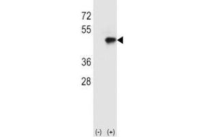 Image no. 1 for anti-CD4 (CD4) (AA 58-86) antibody (ABIN3030390)