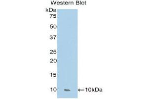 Image no. 1 for anti-Chemokine (C-C Motif) Ligand 17 (CCL17) (AA 27-93) antibody (ABIN1174785)
