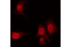 Image no. 1 for anti-Keratin 8 (KRT8) (pSer432) antibody (ABIN6255334)